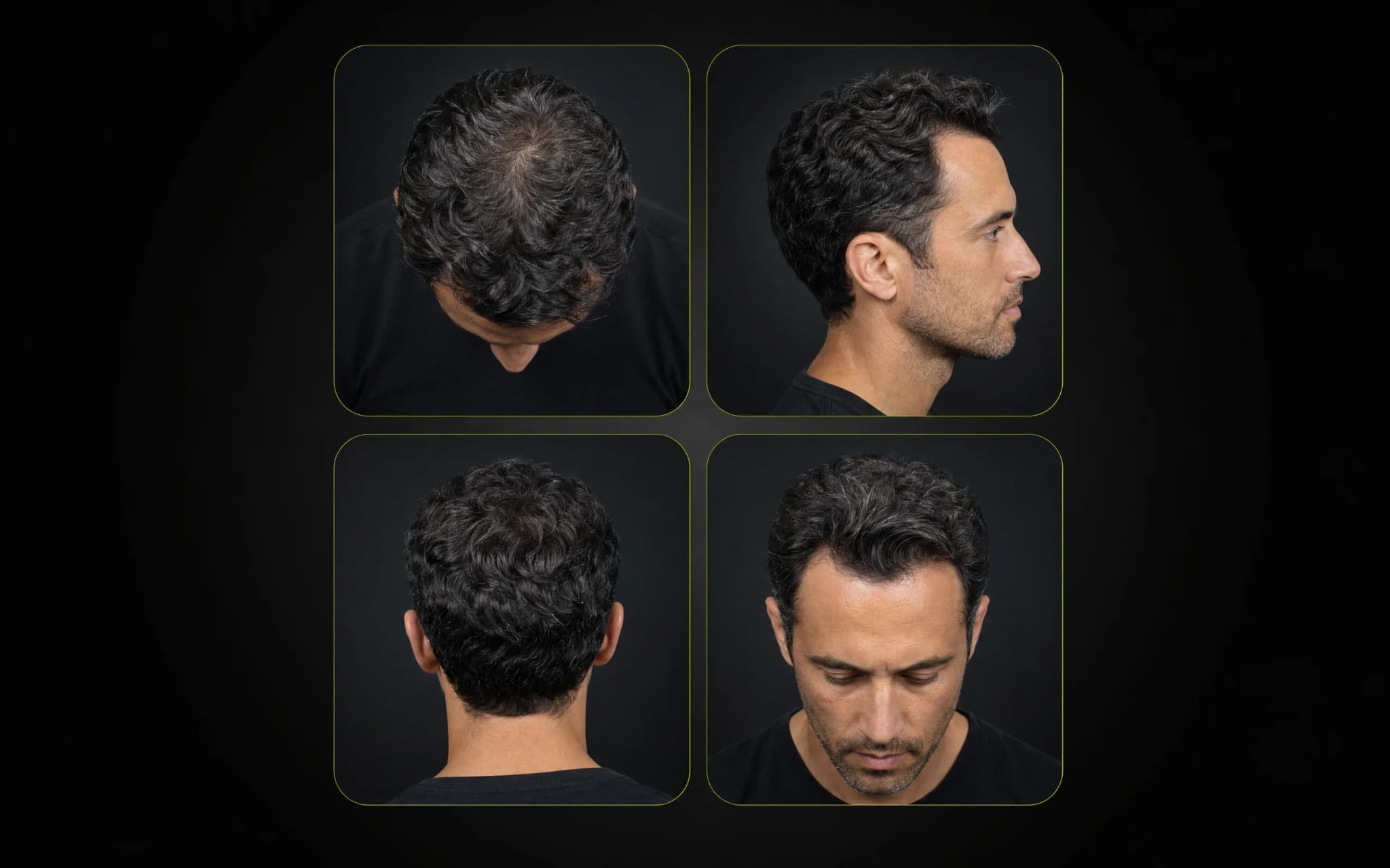The four guided scan angles — top, side, back and front views